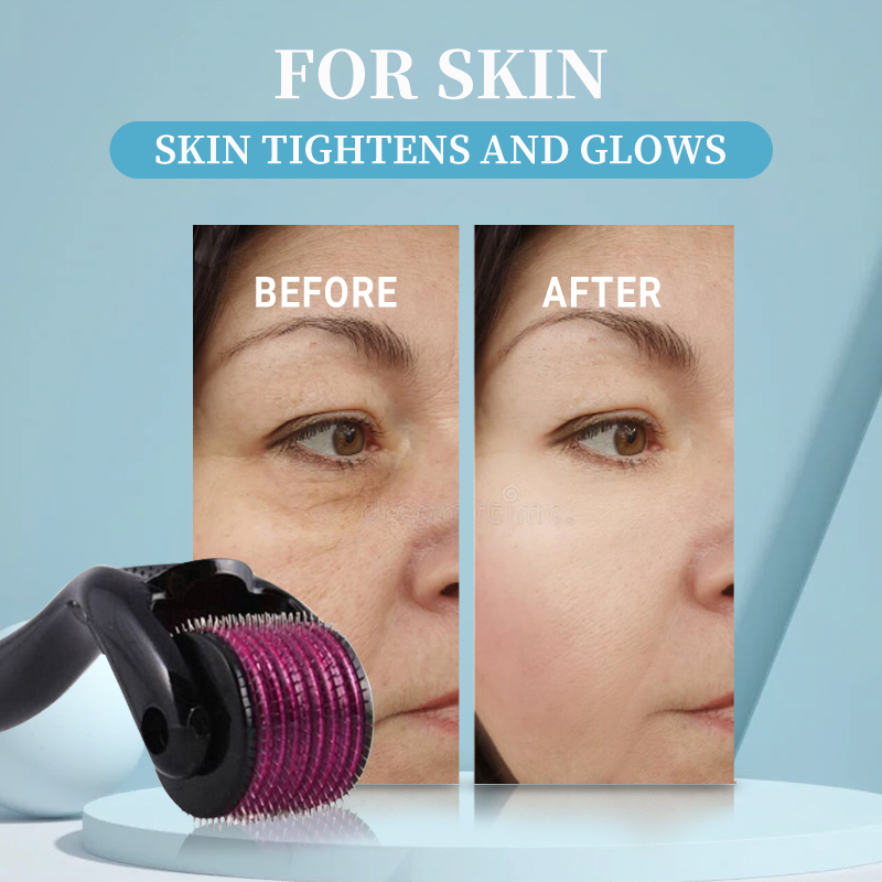 プロ540ローラーダーマ0.2/0.25/0.3mm育毛髭用 - Derma Roller 0.25 のレビューと価格