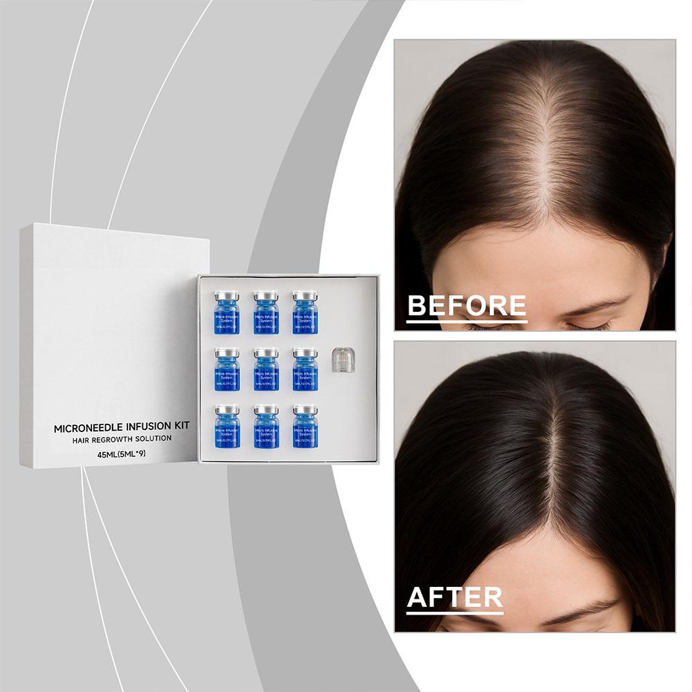 0.25 ミリメートルヘアエッセンシャルセラムマイクロニード - Derma Roller 0.25 のレビューと価格